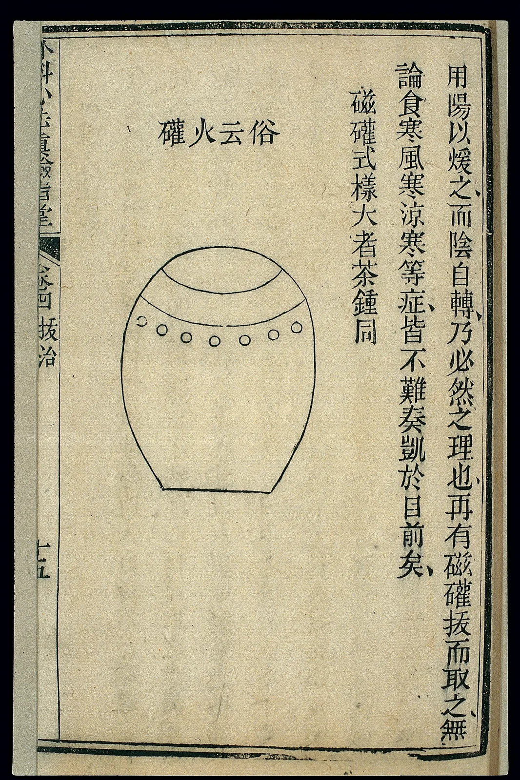 Cupping vessel in Chinese medicine tradition