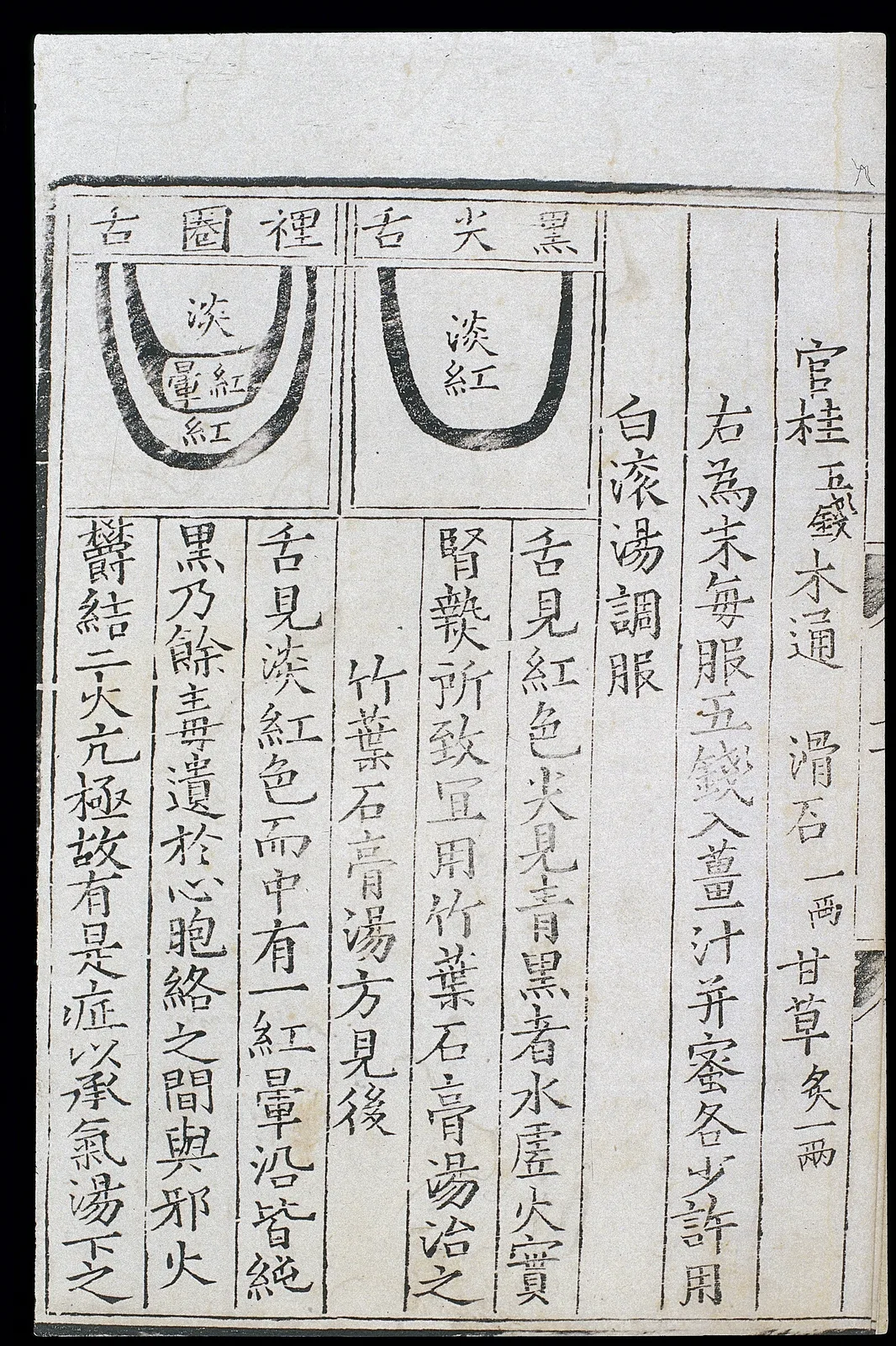 Traditional tongue diagnosis chart in Chinese medicine teaching