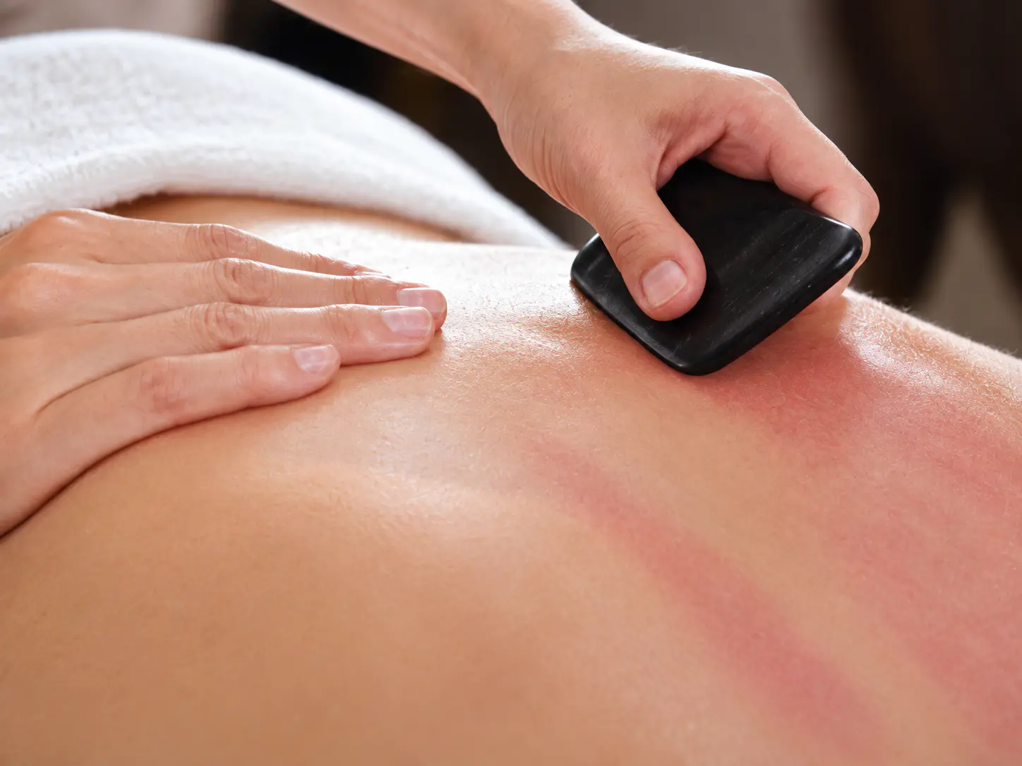 Gua Sha in Traditional Chinese Medicine