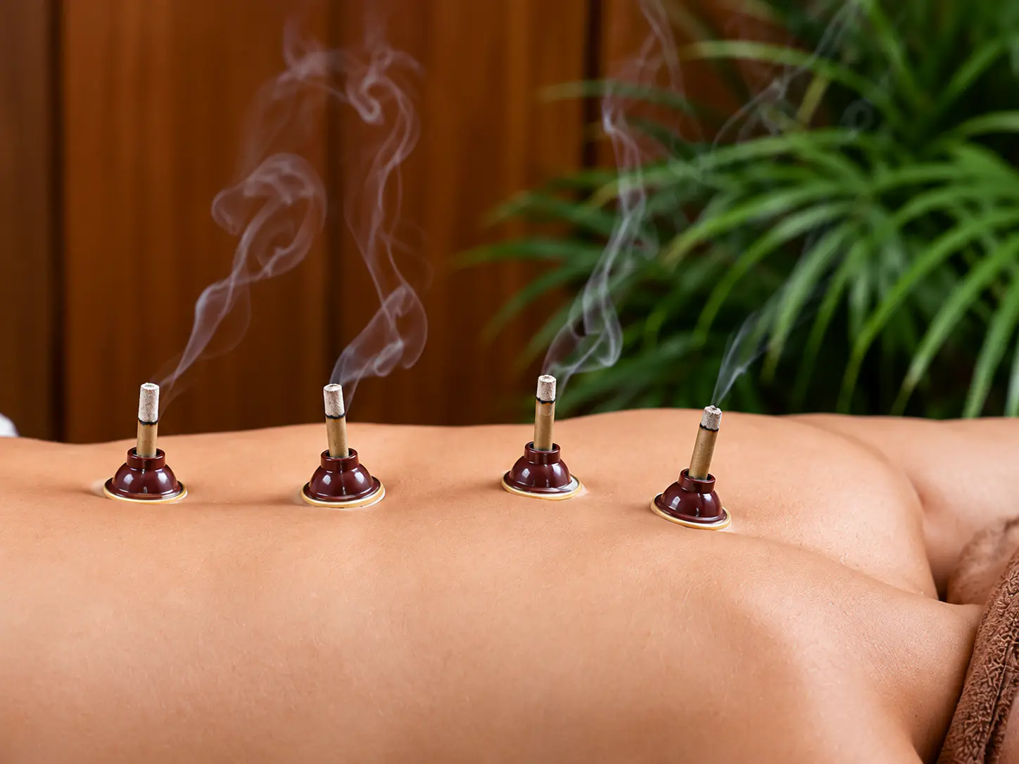 Moxibustion in Traditional Chinese Medicine